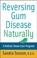 Cover of: Reversing Gum Disease Naturally