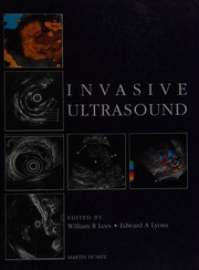 Cover of: Invasive ultrasound by edited by William R. Lees, Edward A. Lyons.
