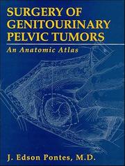 Surgery of genitourinary pelvic tumors by J. Edson Pontes