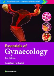 Essentials Of Gynaecology 2Ed
