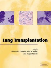 Cover of: Lung Transplantation by 