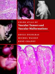 Cover of: Color Atlas of Vascular Tumors and Vascular Malformations by Odile Enjolras, Michel Wassef, Rene Chapot