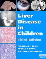Cover of: Liver Disease in Children by 