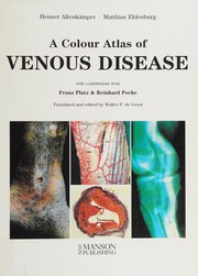 Color atlas of venous disease by H. Altenkämper