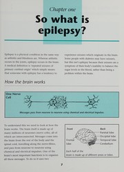 Cover of: Epilepsy by Alice Hanscomb
