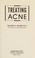 Cover of: Treating acne