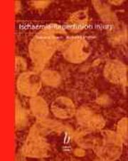 Cover of: Ischaemia reperfusion injury by [edited by] Pierce A. Grace, Robert T. Mathie.