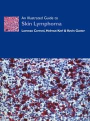 Cover of: An Illustrated Guide to Skin Lymphoma by Lorenzo Cerroni, Helmut Kerl, Kevin Gatter