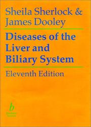 Cover of: Diseases of the Liver & Biliary System | Sheila Sherlock