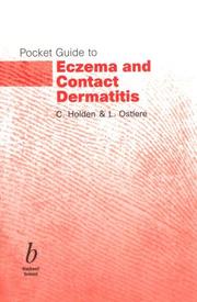 Cover of: Pocket Guide to Eczema and Contact Dermatitis (Pocket Guide)