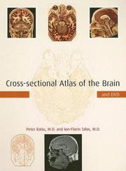 Cover of: Cross-sectional atlas of the brain by Peter Ratiu