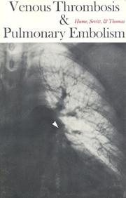 Venous thrombosis and pulmonary embolism by Michael Hume