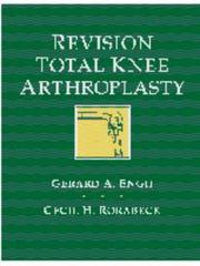 Revision total knee arthroplasty