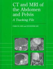 Cover of: CT and MRI of the abdomen and pelvis by Pablo R. Ros