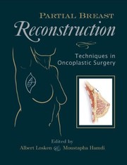 Cover of: Partial breast reconstruction: techniques in oncoplastic surgery
