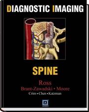 Cover of: Diagnostic Imaging: Spine