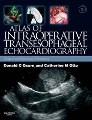 Atlas of intraoperative transesophageal echocardiography by Donald C. Oxorn, Donald Oxorn, Catherine M. Otto