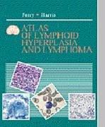 Cover of: Atlas of lymphoid hyperplasia and lymphoma by Judith A. Ferry