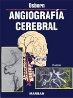 Cover of: Angiografia Cerebral