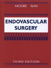 Cover of: Endovascular Surgery by Wesley S. Moore, Samuel S. Ahn