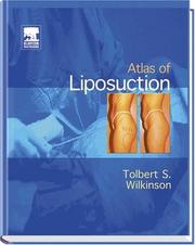Atlas of liposuction by Tolbert S. Wilkinson, Tolbert Wilkinson, Lee Ann Paradise