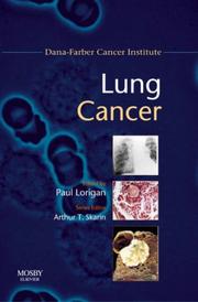 Cover of: Lung Cancer: Dana-Farber Cancer Institute Handbook (Dana-Farber Cancer Institute Handbooks)