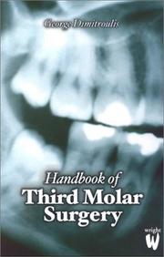Handbook of third molar surgery by George Dimitroulis