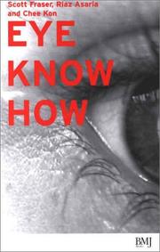 Cover of: Eye Know How