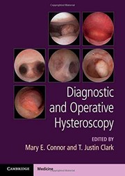 Diagnostic and Operative Hysteroscopy by Mary Connor, Justin Clark, Stephen Burrell