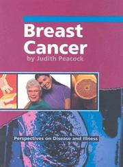 Cover of: Breast cancer by Judith Peacock
