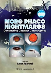 Cover of: More Phaco Nightmares: Conquering Cataract Catastrophes