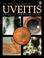 Cover of: Uveitis