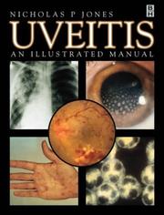 Cover of: Uveitis: An Illustrated Manual
