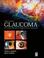 Cover of: Glaucoma