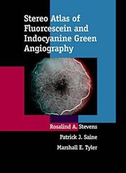 Cover of: Stereo atlas of fluorescein and indocyanine green angiography by Rosalind A. Stevens