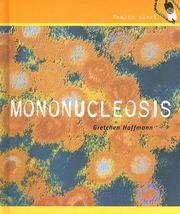 Mononucleosis