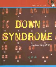 Cover of: Down Syndrome (Health Aleart) by Marlene Targ Brill