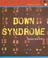 Cover of: Down Syndrome (Health Aleart)