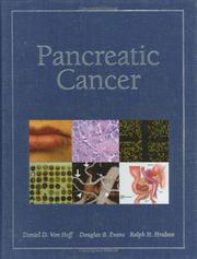 Cover of: Pancreatic Cancer by 