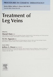 Cover of: Treatment of leg veins