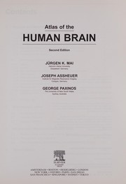Cover of: Atlas of the human brain by Jürgen K. Mai