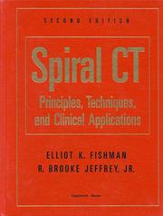 Cover of: Spiral CT by editors, Elliot K. Fishman, R. Brooke Jeffrey, Jr.