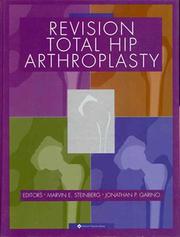 Revision total hip arthroplasty