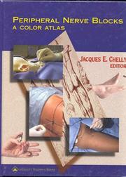 Cover of: Peripheral Nerve Blocks: A Color Atlas