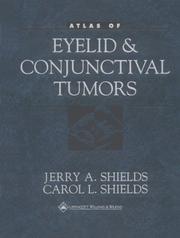 Cover of: Atlas of eyelid and conjunctival tumors by Jerry A. Shields