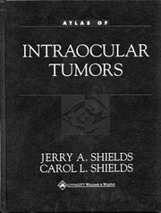 Cover of: Atlas of intraocular tumors by Jerry A. Shields