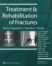 Treatment and Rehabilitation of Fractures by Stanley Hoppenfeld