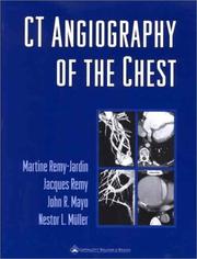 Cover of: CT Angiography of the Chest