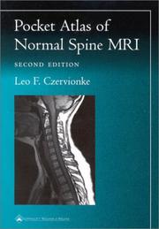 Cover of: Pocket Atlas of Spinal MRI (Radiology Pocket Atlas Series) by Leo F. Czervionke