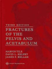 Cover of: Fractures of the Pelvis and Acetabulum by Marvin Tile, David L Helfet, James F Kellam